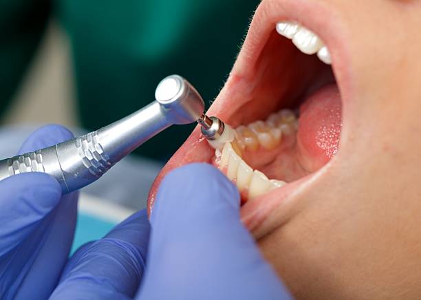 Best Wisdom Tooth Removal  in North Port, FL